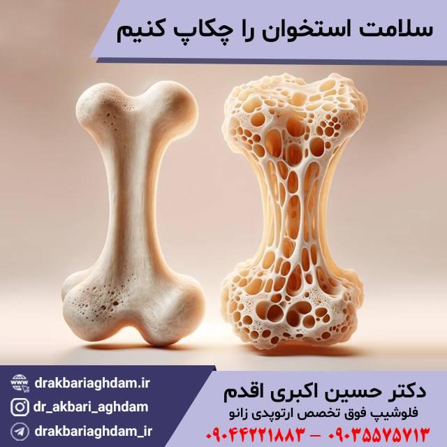 سلامت-استخوان-را-چکاپ-کنیم