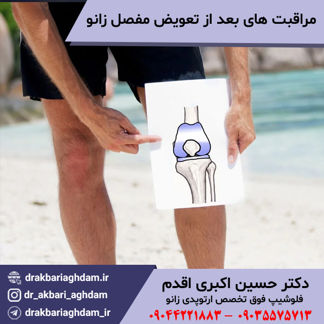 مراقبت-های-بعد-از-تعویض-مفصل-زانو-که-مهم-است