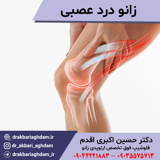 زانو-درد-عصبی