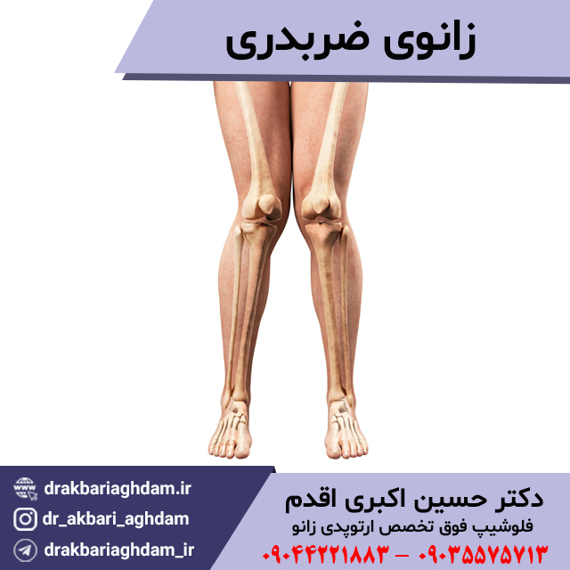 زانوی-ضربدری