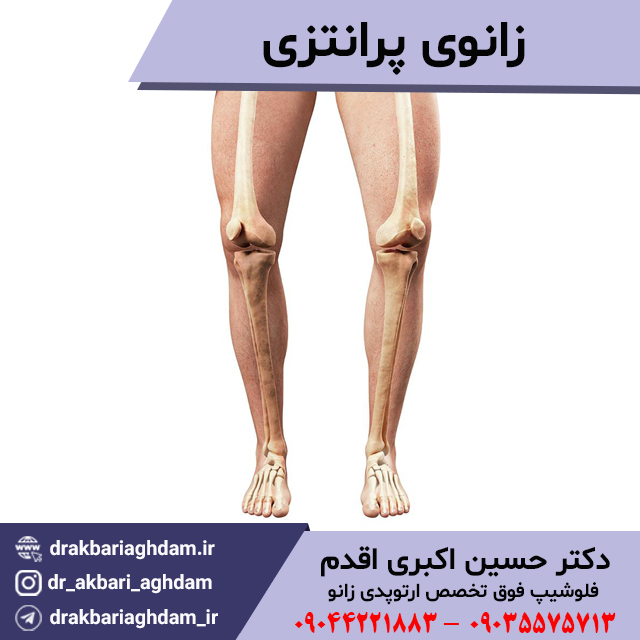 زانوی-پرانتزی