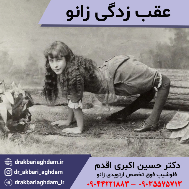 عقب-زدگی-زانو-چیست؟