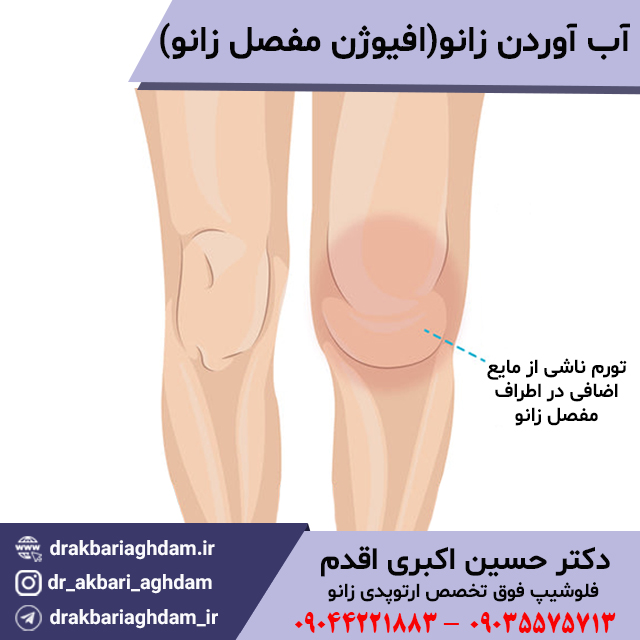 وقتی-زانو-آب-می آورد