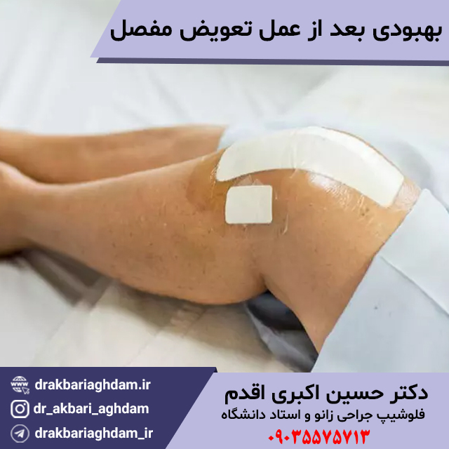 بهبودی-بعد-از-عمل-تعویض-مفصل