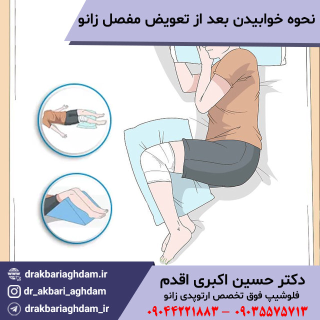 نحوه-خوابیدن-بعد-از-تعویض-مفصل