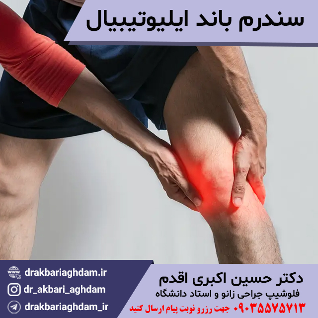سندرم-باند-ایلیوتیبیال