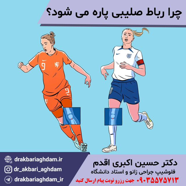 چرا-رباط-صلیبی-پاره-می-شود